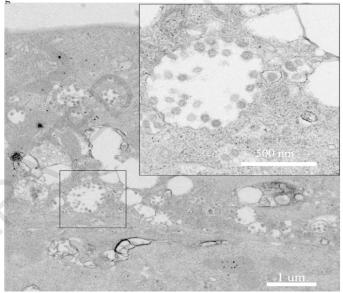 揭秘最新病毒形态特征与科学研究，病毒新貌解析